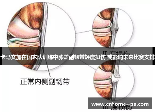 卡马文加在国家队训练中膝盖副韧带轻度扭伤 或影响未来比赛安排